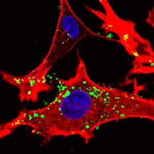 IIT’s new nanoparticles for nanomedicine