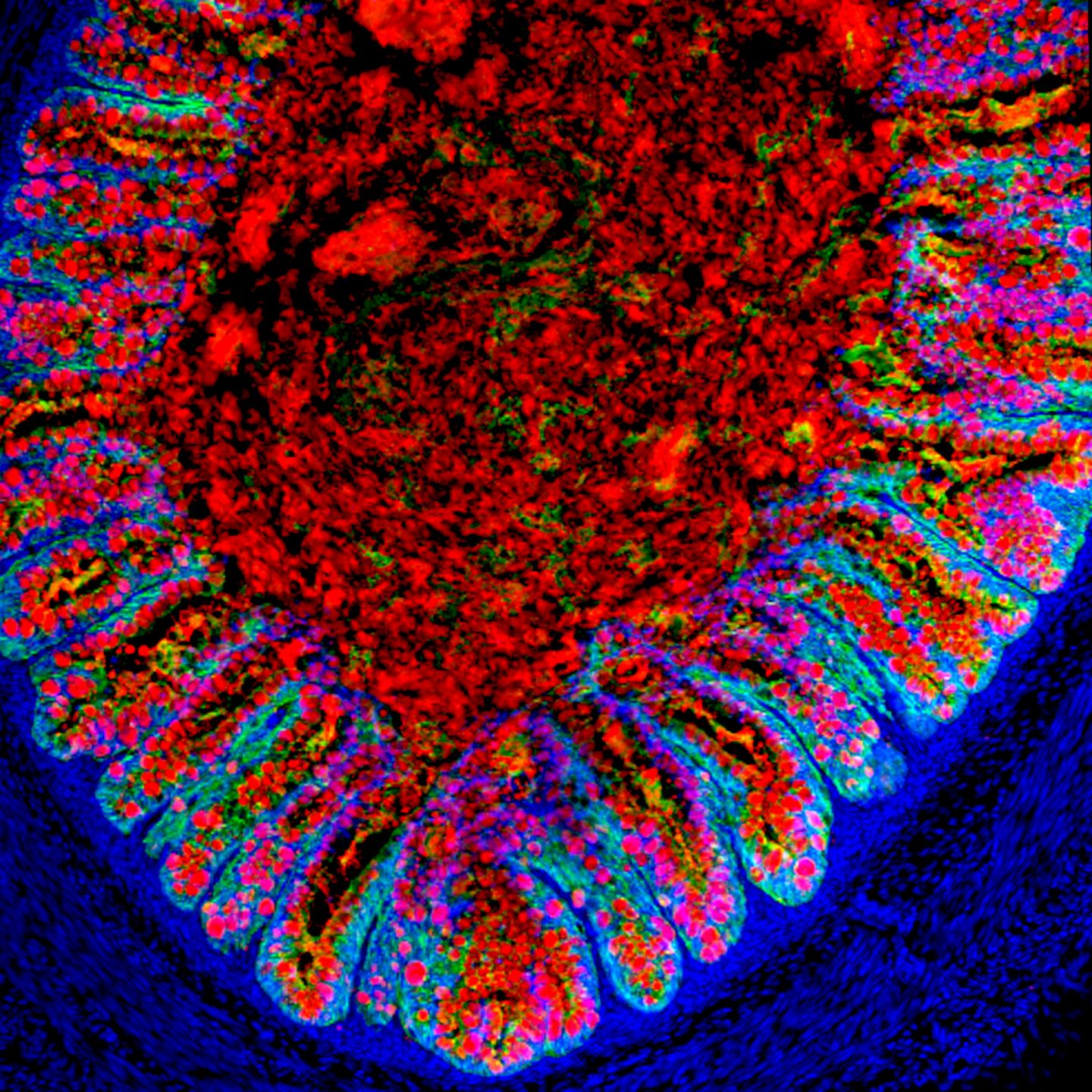 Lab-Grown Human Colon
