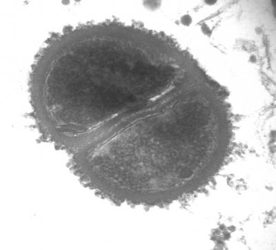 MRSA