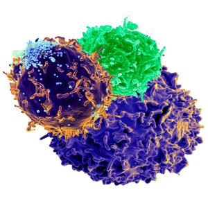 Regulatory T cell (Treg) therapy has potential for managing self-antigen reactive disorders