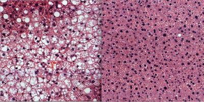 Liver Tissue