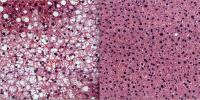 Liver Tissue