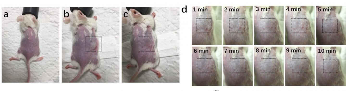 Recovery of skin after application with cryomicroneededs.