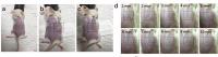 Recovery of skin after application with cryomicroneededs.