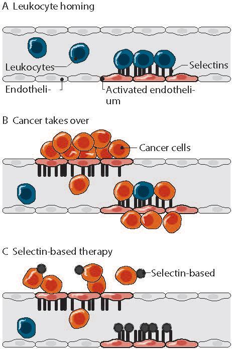 Radiation-Guided Nanoparticles Zero in on Metastatic Cancer