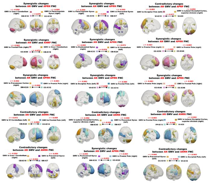 Fig. 3 | Synergistic and contradictory joint changes between FNC and GMV.