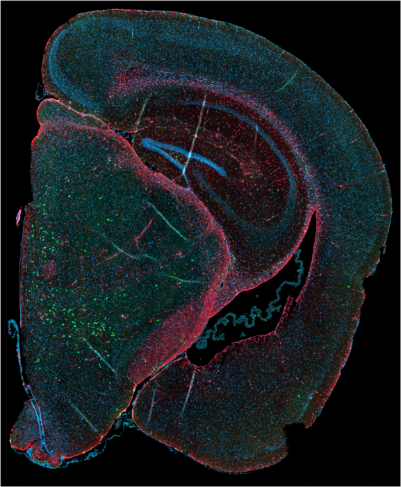 Neuropathological inclusions