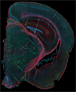 Neuropathological inclusions