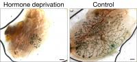 Effect of Hormone Deprivation on Breast Stem Cells