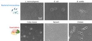 Food debris and bacteria