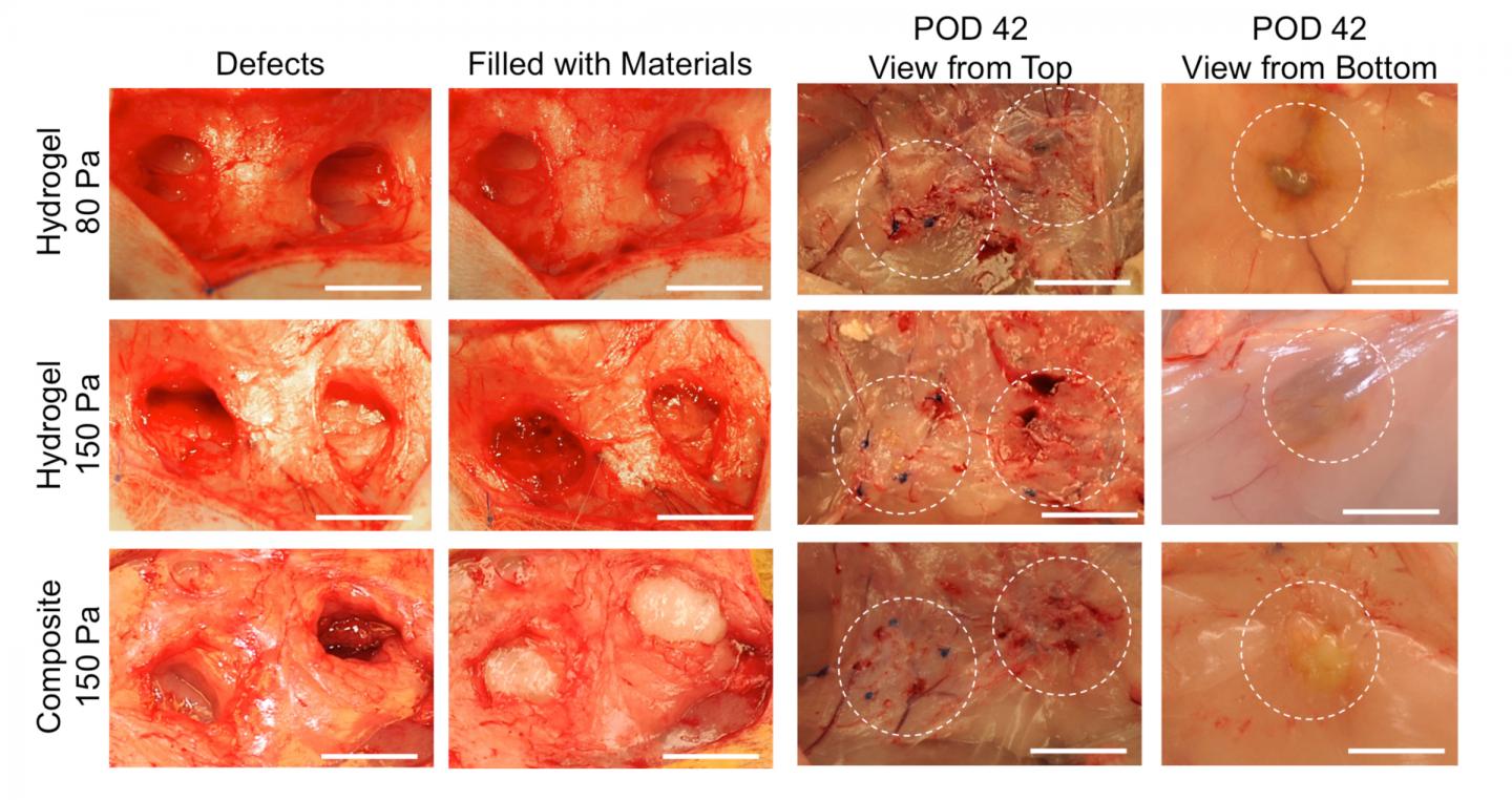 Two Tissue Defects