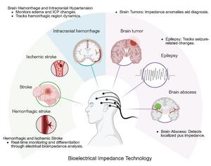 Clinical Applications of Bioelectrical Impedance Technology in Neurological Diseases