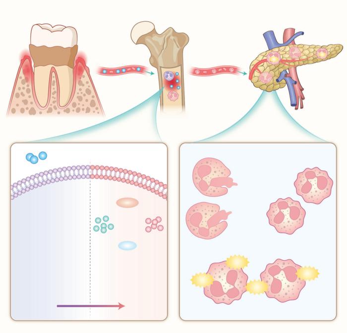 More than gum deep: Periodontitis reprograms bone marrow neutrophils to fuel systemic inflammation