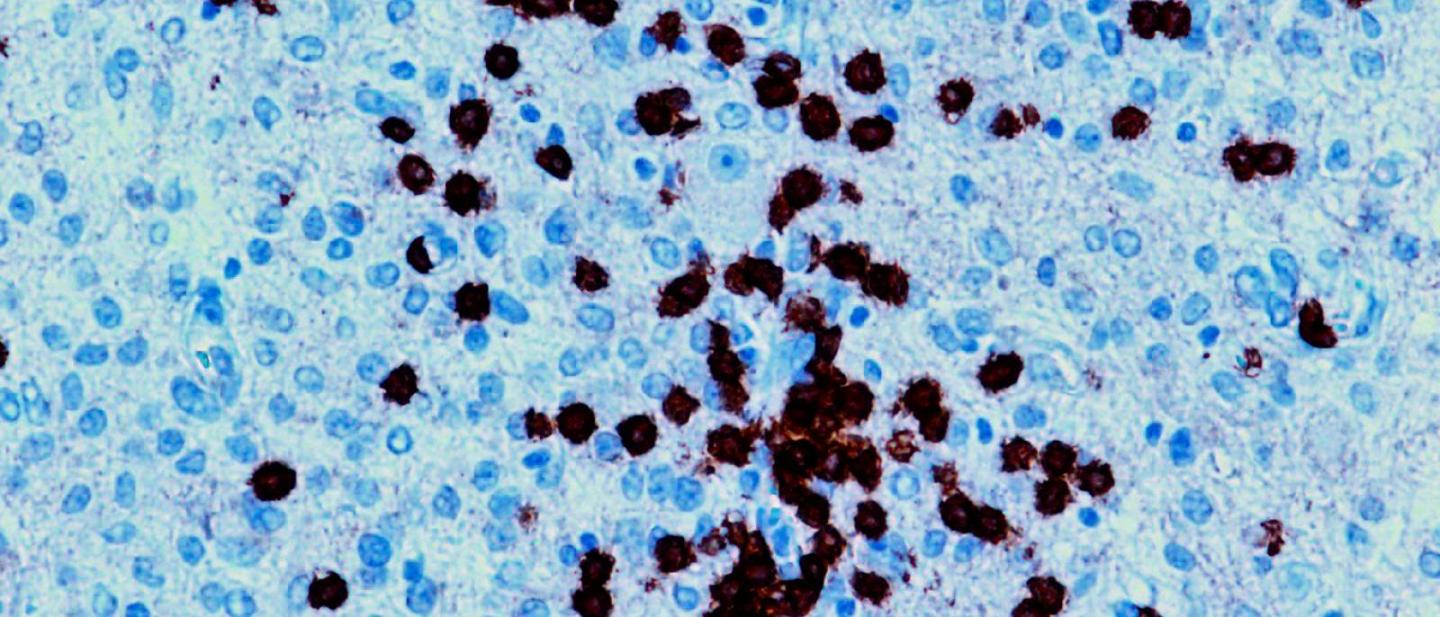 Immune Cells