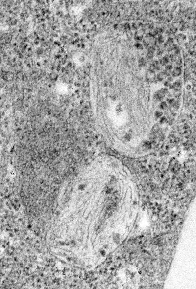 Protein Sorting in Pigment Cells Sheds Light on Melanoma, Alzheimer's Disease