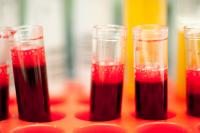 Blood Sample Test Tubes