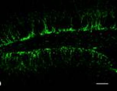 Effect of Prenatal Alcohol Exposure on Newborn Neurons
