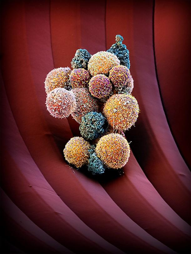 CTC Cluster, Imaged with Electron Microscopy