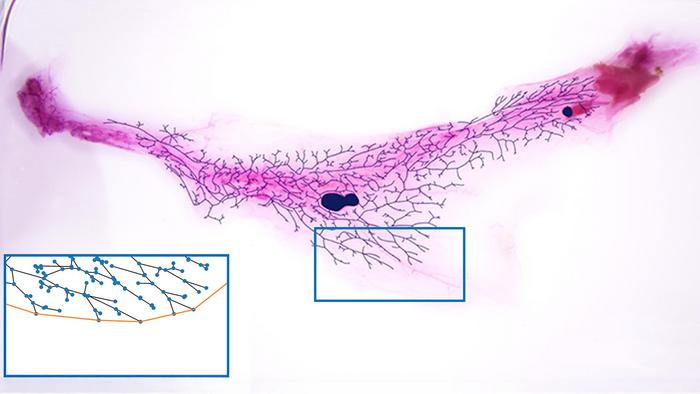 MaGNet ductal tree