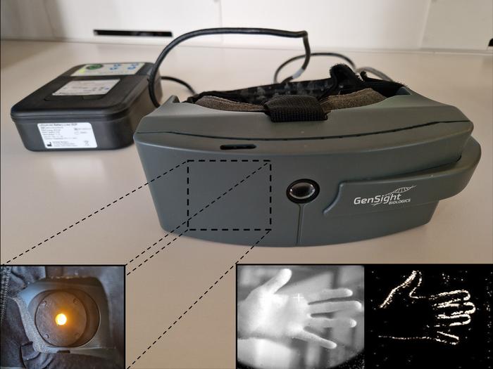 Optogenetic therapy safe, shows signs of vision restoration in patients ...