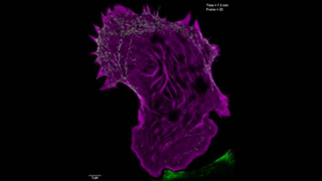 Improved Microscopy Technique Reveals New Insights into Cell Processes (1 of 7)