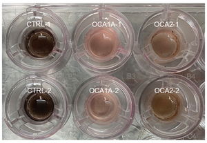 iPSCs stem cell colony