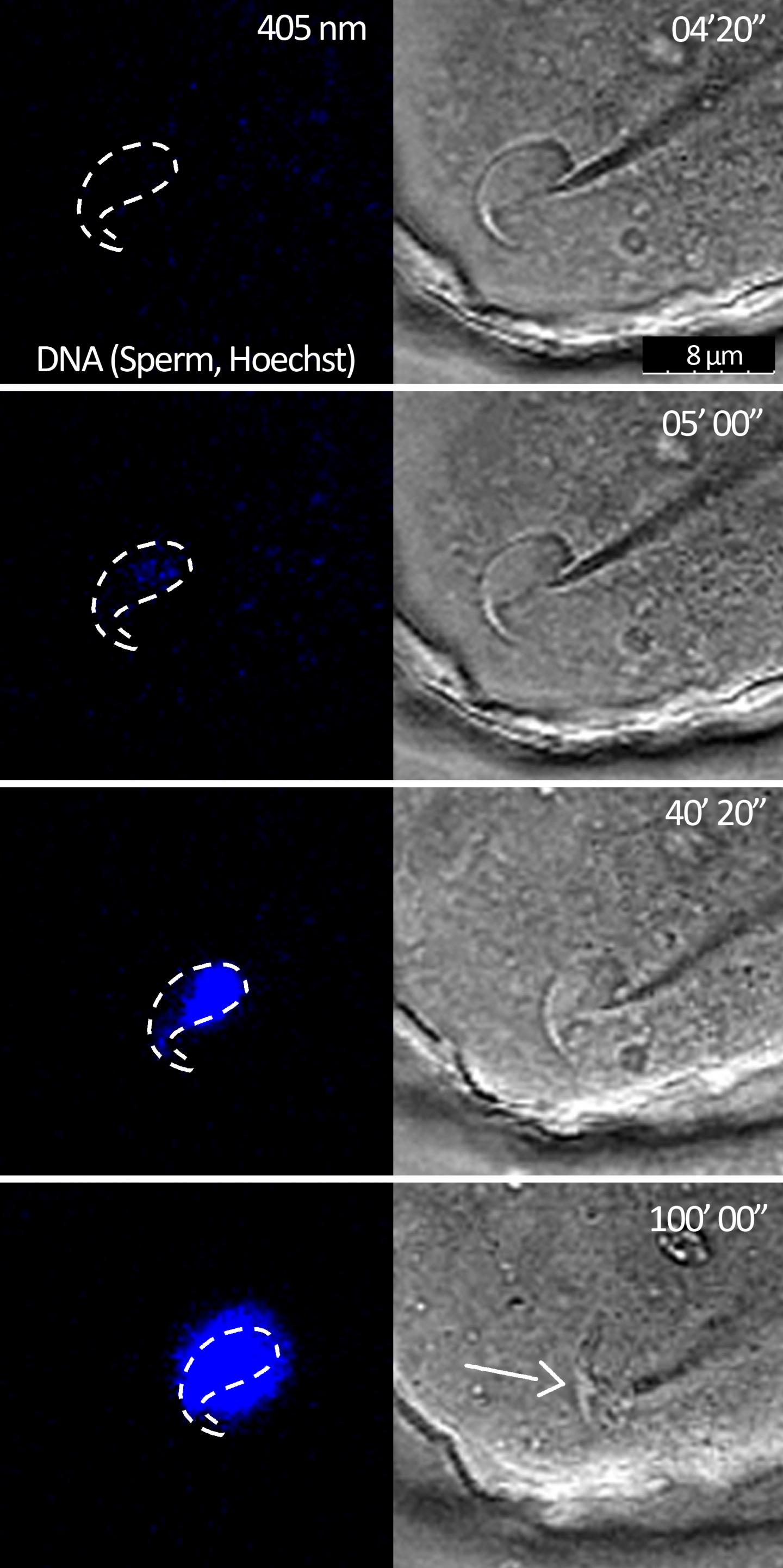 Gamete Fusion and Sperm DNA Internalization