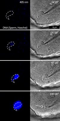 Gamete Fusion and Sperm DNA Internalization