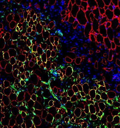 Mesenchymal Stem Cell Co-Transplantation in a Mouse