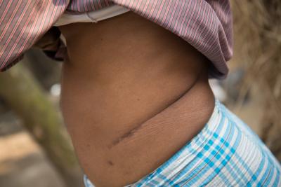 Man's Scar