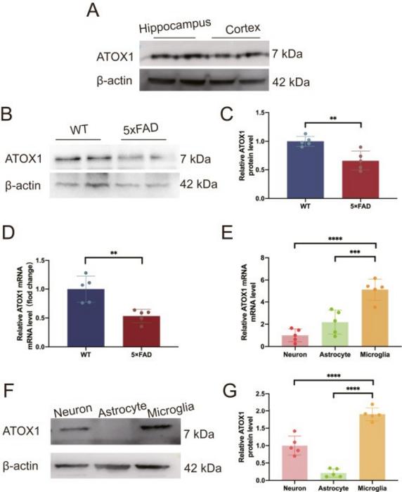 Expression of ATOX1 in Alzheimer's disease.