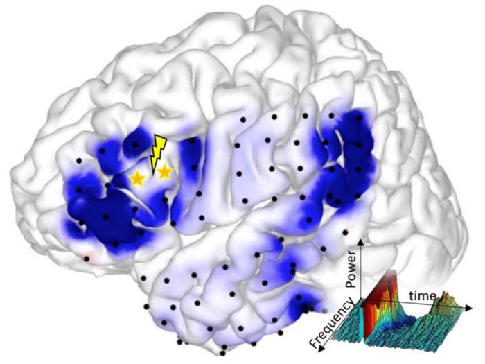 Electric brain stimulation