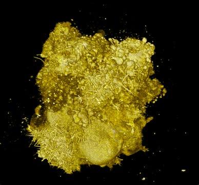 Lung Cancer Cells