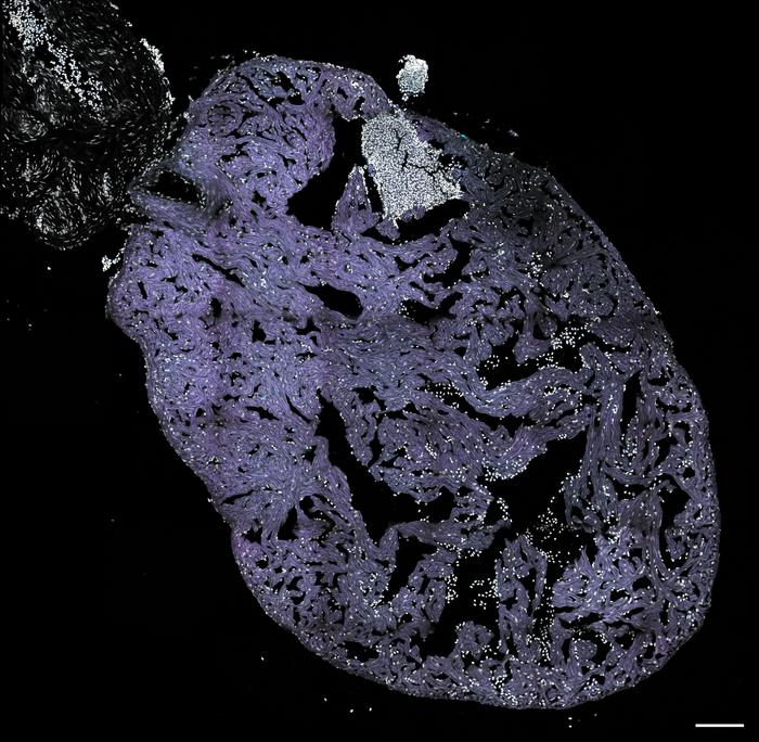 A zebrafish heart, 6 hours after cryoinjury