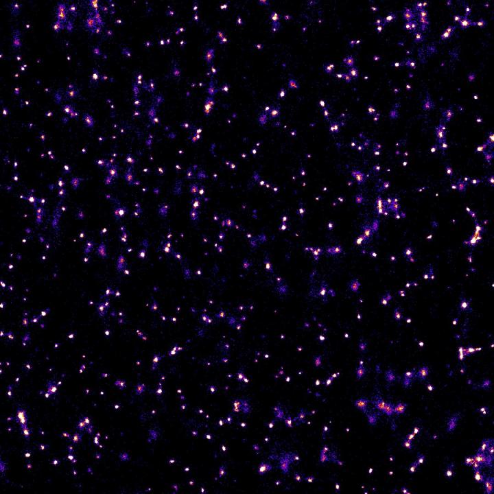 Super-Resolution Microscopy Image of the Vesicles