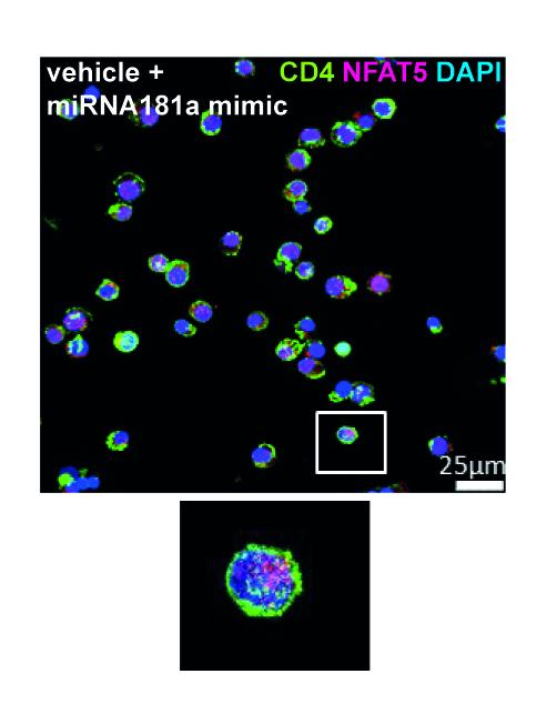 Targeting a Tiny RNA Molecule to Halt Type 1 Diabetes (2 of 3 )