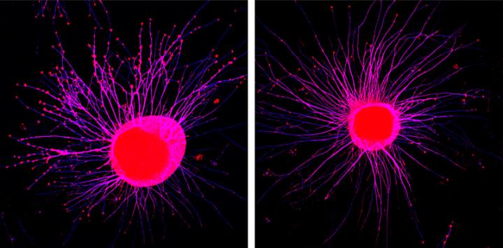 Nerve Cell Filaments