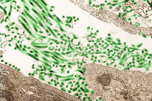 High Doses of Antiviral Drug May be Effective Against Ebola