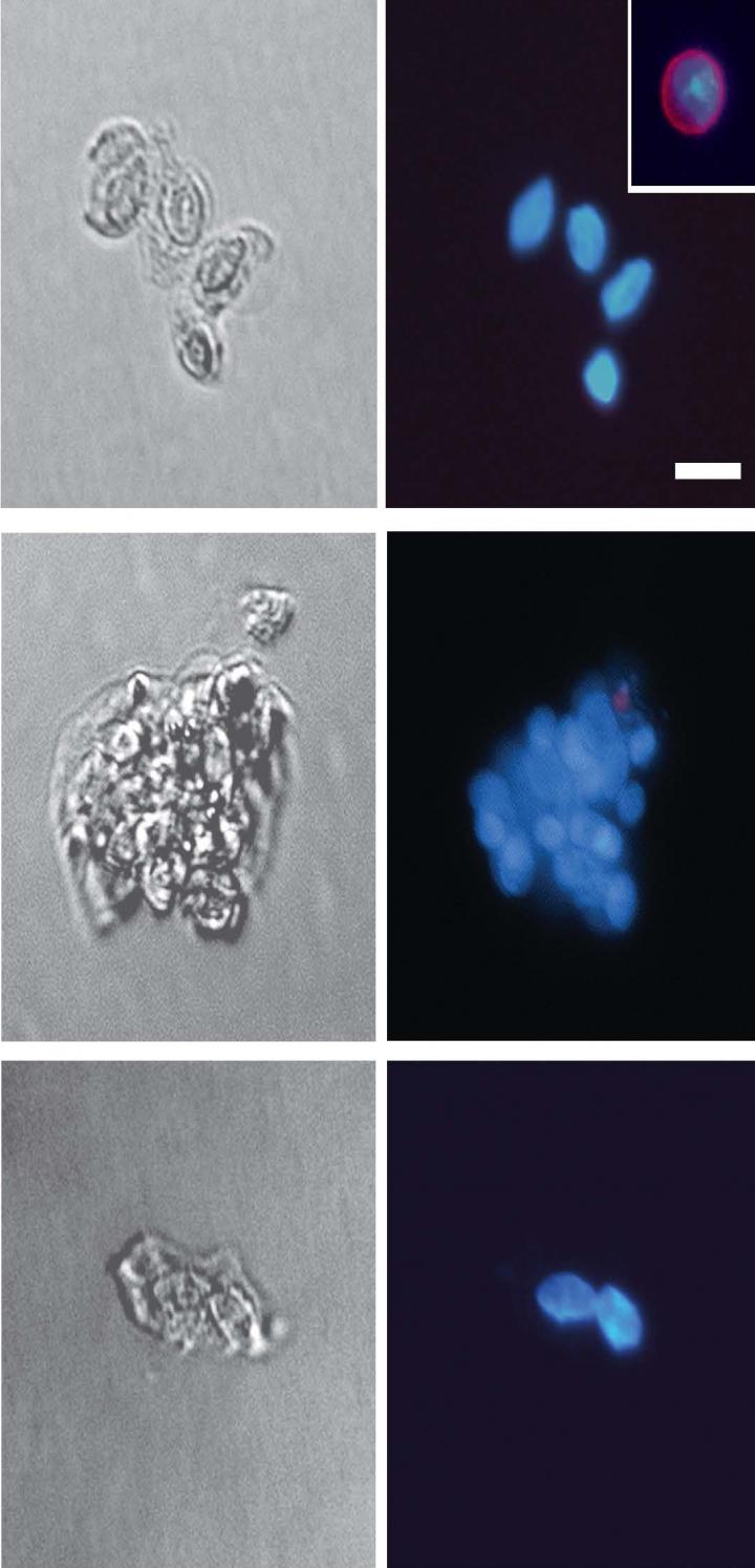 Cell Clusters in the Blood Not Malignant After All, But Open Window ...