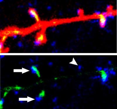 Image from Jan. 28 Journal of Neuroscience