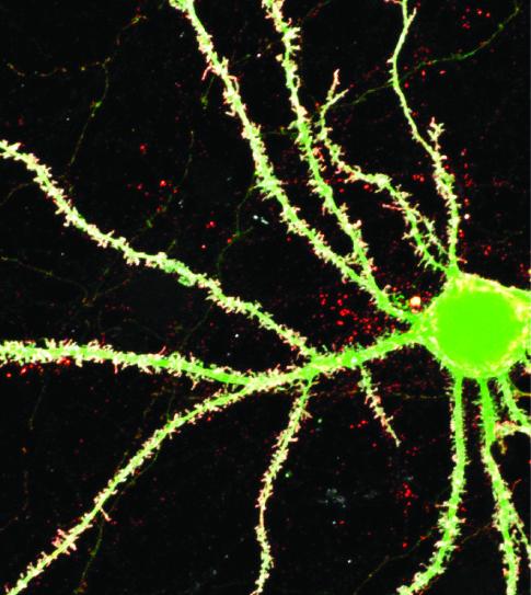 Genetics of Autism-Spectrum Disorder