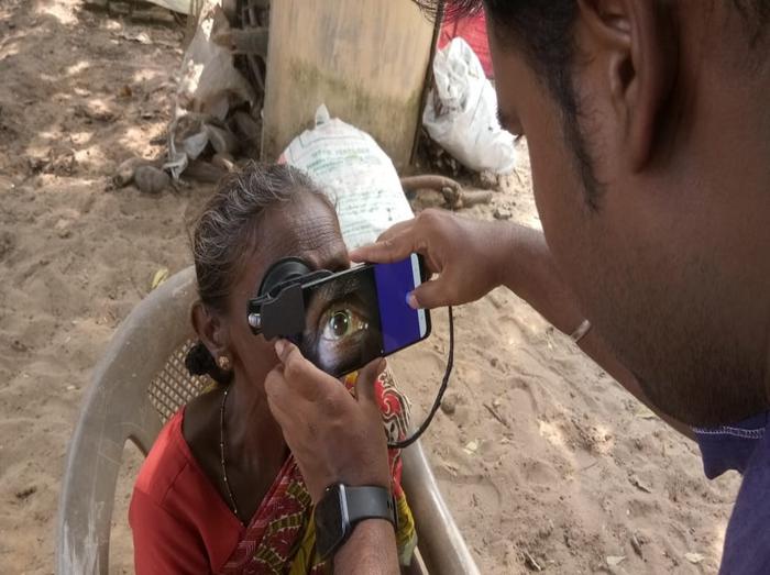 Smartphones could be used to screen for cataracts and other eye problems