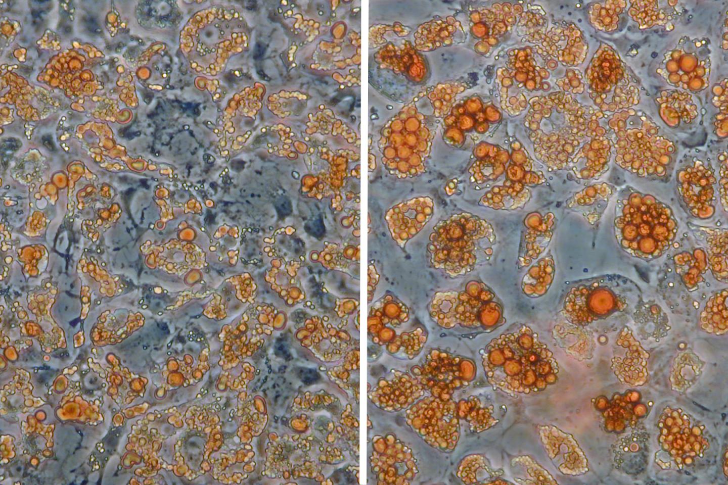 Stained Adipocytes