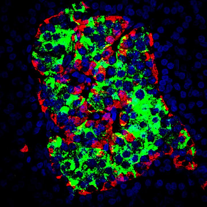 Human Islet of Langerhans