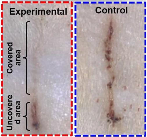 E-bandage Generates Electricity, Speeds Wound Healing in Rats