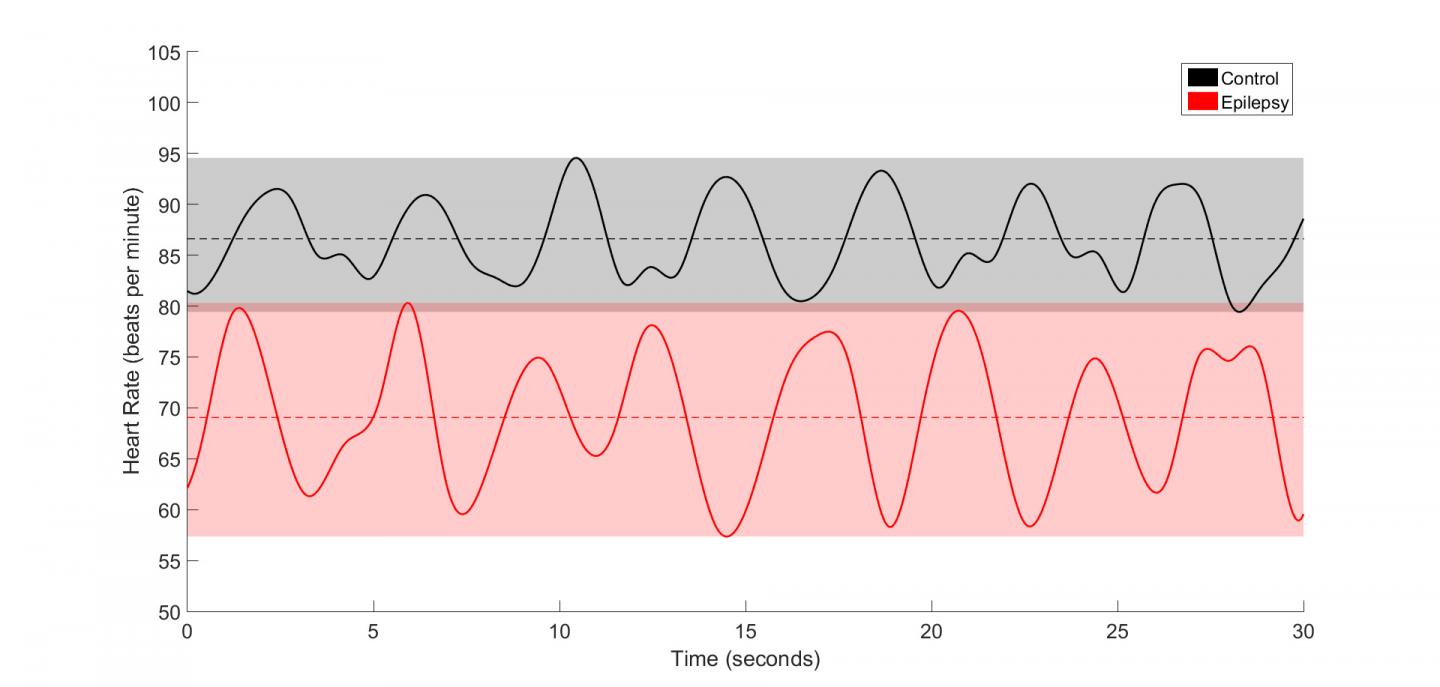 Electrocardiogram Comparisons Highlight the Differences