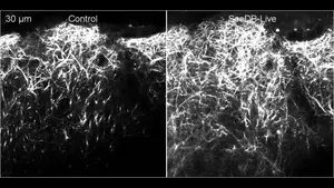 Fluorescence images of a live mouse brain, before and after clearing