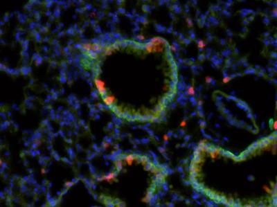 The Airways of the Mouse Lung (1 of 2)