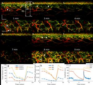 Figure 2 | 3D-RSOM imaging of skin microvasculature hyperemia during PORH.