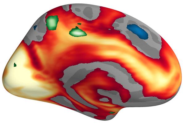 Brain Activity When Viewing Negative Emotional Images